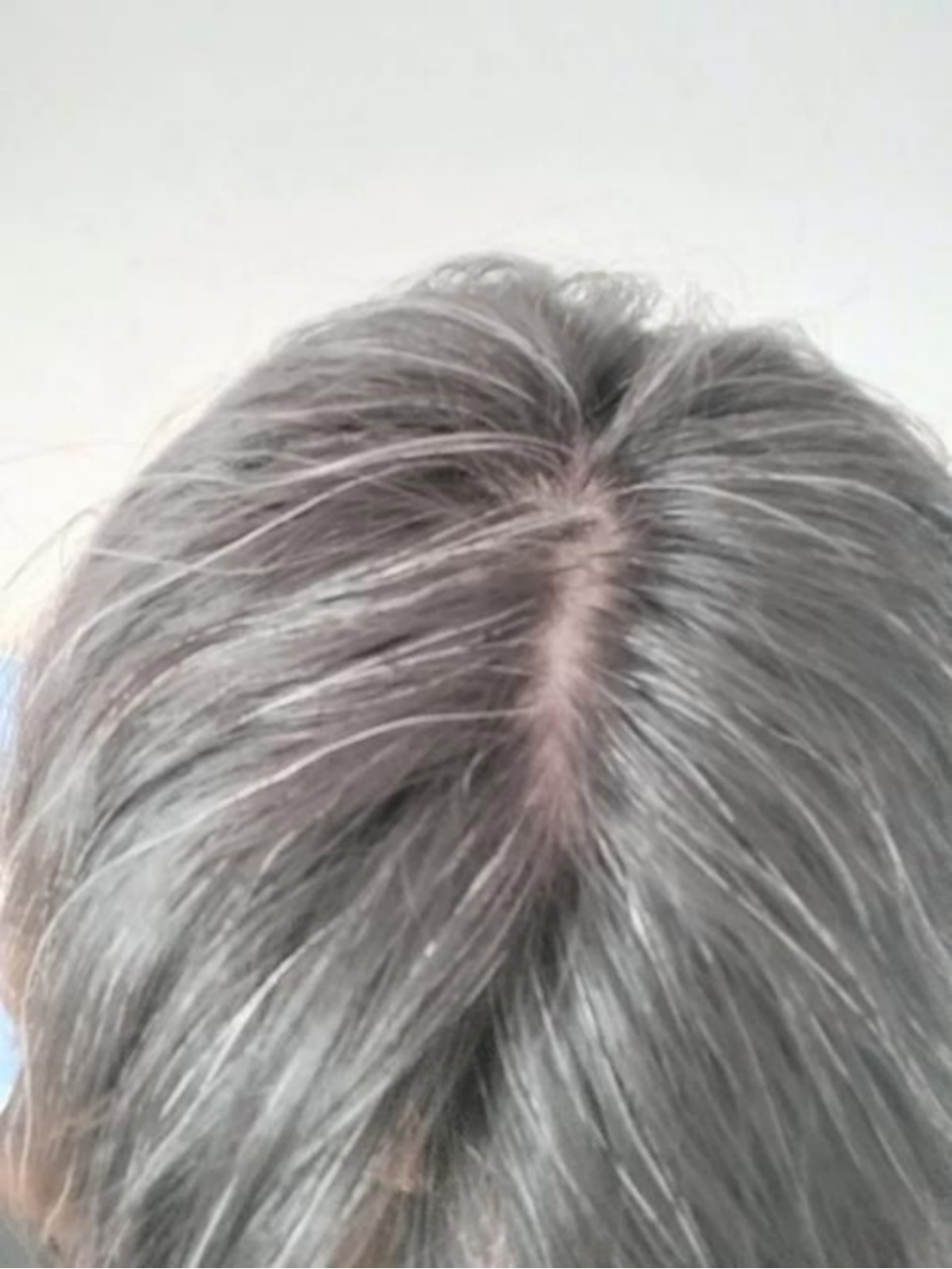 女性白发.png